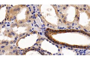 Detection of KRT6A in Human Kidney Tissue using Polyclonal Antibody to Keratin 6A (KRT6A)