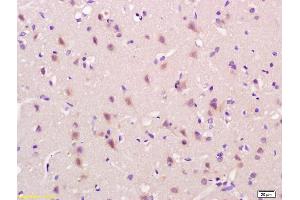 Formalin-fixed and paraffin embedded rat brain labeled with Anti-OB/CDH11/OB-Cadherin Polyclonal Antibody, Unconjugated (ABIN1387539) at 1:200 followed by conjugation to the secondary antibody and DAB staining.