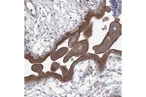 Immunohistochemical staining of human placenta with CPEB4 polyclonal antibody  shows strong membranous and cytoplasmic positivity in trophoblastic cells at 1:200-1:500 dilution.