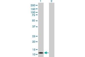 Western Blot analysis of CALML3 expression in transfected 293T cell line by CALML3 MaxPab polyclonal antibody. (CALML3 anticorps  (AA 1-149))