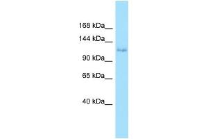WB Suggested Anti-EPHA6 Antibody Titration: 1. (EPH Receptor A6 anticorps  (N-Term))