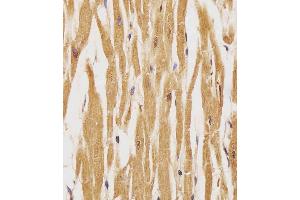 (ABIN389572 and ABIN2839598) staining HER4 in human heart tissue sections by Immunohistochemistry (IHC-P - paraformaldehyde-fixed, paraffin-embedded sections). (ERBB4 anticorps  (pTyr1162))
