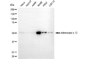 Western blotting analysis using adrenoceptor alpha 1B antibody (ABIN7797535).