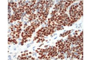 Immunohistochemistry (IHC) image for anti-Myogenin (Myogenic Factor 4) (MYOG) antibody (ABIN953581) (Myogenin anticorps)