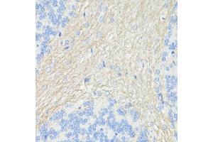 Immunohistochemistry of paraffin-embedded rat brain using CD90/Thy1 antibody (ABIN7266228) at dilution of 1:100 (40x lens). (CD90 anticorps  (AA 31-81))