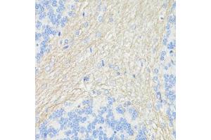 Immunohistochemistry of paraffin-embedded rat brain using CD90/Thy1 antibody (ABIN7266228) at dilution of 1:100 (40x lens).