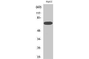 Western Blotting (WB) image for anti-Mitogen-Activated Protein Kinase Kinase Kinase 3 (MAP3K3) (Internal Region) antibody (ABIN3180171) (MAP3K3 anticorps  (Internal Region))