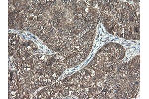 Image no. 5 for anti-Pyridoxamine 5'-Phosphate Oxidase (PNPO) antibody (ABIN1500318)