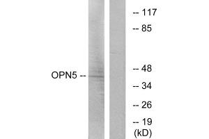 Western blot analysis of extracts from Jurkat cells, using OPN5 antibody. (OPN5 anticorps  (C-Term))