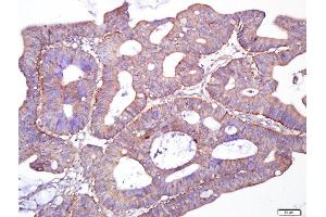 Paraformaldehyde-fixed, paraffin embedded human cervix cancer, Antigen retrieval by boiling in sodium citrate buffer (pH6.