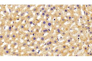 Detection of PLCe1 in Mouse Liver Tissue using Polyclonal Antibody to Phospholipase C Epsilon 1 (PLCe1) (PLCE1 anticorps  (AA 1-250))
