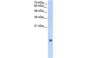 Western Blotting (WB) image for anti-Histone Cluster 2, H2aa3 (HIST2H2AA3) antibody (ABIN2463431)