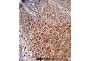 Immunohistochemistry (IHC) image for anti-Immunoglobulin Heavy Chain (IgH) antibody (ABIN2995207)