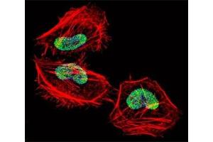 Fluorescent confocal image of HeLa cell stained with HDAC4 antibody at 1:25.