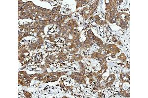 IHC analysis of CBR1 using anti-CBR1 antibody (ABIN7600015). (CBR1 anticorps  (AA 14-262))