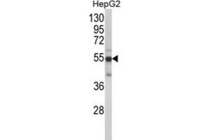 Western Blotting (WB) image for anti-Cytochrome P450, Family 2, Subfamily J, Polypeptide 2 (CYP2J2) antibody (ABIN3003218)