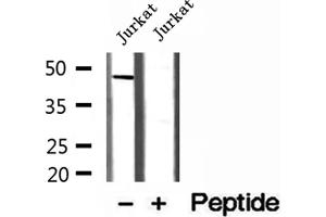 Western blot analysis of extracts of Jurkat cells, using MAGT1 antibody. (MAGT1 anticorps  (Internal Region))