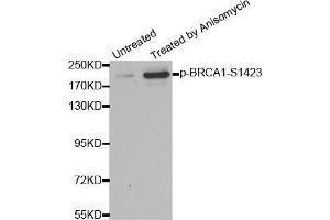 Western blot analysis of extracts from HT29 cells, using Phospho-BRCA1-S1423 antibody (BRCA1 anticorps  (pSer1423))