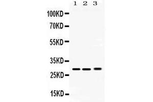 Western blot analysis of PSMA3 expression in rat testis extract ( Lane 1), mouse lung extract ( Lane 2) and 293T whole cell lysates ( Lane 3). (PSMA3 anticorps  (Middle Region))