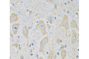Immunohistochemistry of paraffin-embedded Mouse brain using EPHA2 Polyclonal Antibody at dilution of 1:100 (40x lens). (EPH Receptor A2 anticorps)