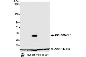 Western Blotting (WB) image for anti-Achaete-Scute Complex Homolog 1 (Drosophila) (ASCL1) (AA 186-236) antibody (ABIN7455113) (Recombinant ASCL1 anticorps  (AA 186-236))