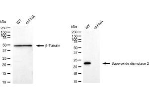 Western blotting analysis using Superoxide dismutase 2 antibody (ABIN7800463). (Recombinant SOD2 anticorps)