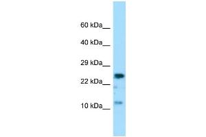 Host: Rabbit Target Name: COX7A2 Sample Type: MCF7 Whole Cell lysates Antibody Dilution: 1. (COX7A2 anticorps  (Middle Region))