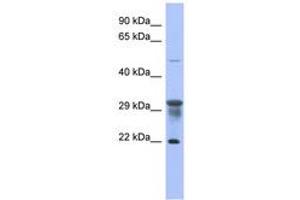 Image no. 1 for anti-Phosphomannomutase 1 (PMM1) (N-Term) antibody (ABIN6744071)