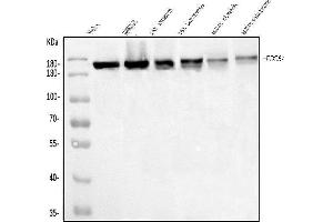 Western blot analysis of SCC112/PDS5A using anti-SCC112/PDS5A antibody (ABIN7598982).