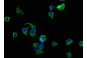 Immunofluorescence staining of MCF-7 cells with ABIN7175412 at 1:200, counter-stained with DAPI. (AVPR2 anticorps  (AA 221-271))