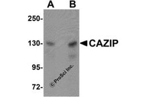 Western Blotting (WB) image for anti-Microtubule-associated Tumor Suppressor Candidate 2 (MTUS2) (C-Term) antibody (ABIN1030322) (CAZIP anticorps  (C-Term))