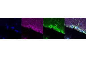 Immunohistochemistry (IHC) image for anti-Coiled-Coil Domain Containing 153 (CCDC153) antibody (ABIN7456016)