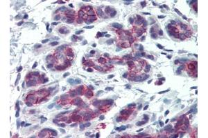 Human Breast (formalin-fixed, paraffin-embedded) stained with SDC1at 15 µg/ml followed by biotinylated goat anti-rabbit IgG secondary antibody, alkaline phosphatase-streptavidin and chromogen. (Syndecan 1 anticorps  (AA 18-218))