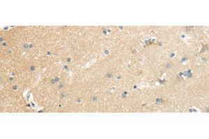 Immunohistochemistry of paraffin-embedded Human brain using SLC7A11 Polyclonal Antibody at dilution of 1/35 (SLC7A11 anticorps)