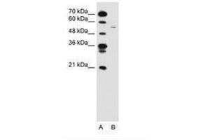 Image no. 1 for anti-Cyclin B1 (CCNB1) (C-Term) antibody (ABIN6736592) (Cyclin B1 anticorps  (C-Term))