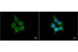 ICC/IF Image HHIP antibody [N3C2], Internal antibody detects HHIP protein by immunofluorescent analysis.