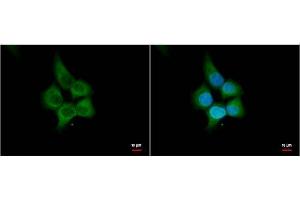 ICC/IF Image HHIP antibody [N3C2], Internal antibody detects HHIP protein by immunofluorescent analysis. (HHIP anticorps)
