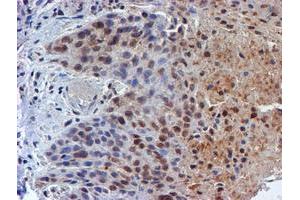 Image no. 9 for anti-RuvB-Like 2 (E. Coli) (RUVBL2) (AA 113-370) antibody (ABIN1490851)