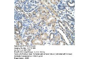 Rabbit Anti-PRPS2 Antibody  Paraffin Embedded Tissue: Human Kidney Cellular Data: Epithelial cells of renal tubule Antibody Concentration: 4. (PRPS2 anticorps  (Middle Region))