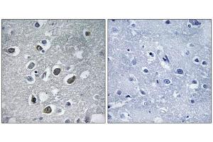 Immunohistochemistry analysis of paraffin-embedded human brain tissue using MARCH4 antibody. (MARCH4 anticorps  (C-Term))