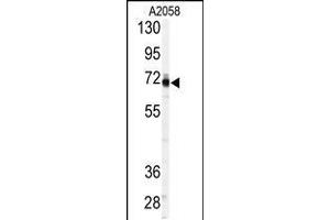 Western blot analysis of anti-P in A2058 cell line lysates (35ug/lane). (PAPSS1 anticorps  (C-Term))
