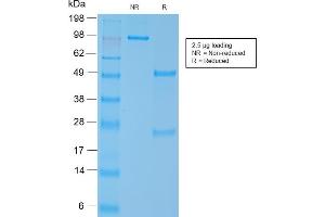 SDS-PAGE Analysis Purified SM-MHC Recombinant Rabbit Monoclonal Antibody (MYH11/2303R). (Recombinant MYH11 anticorps)