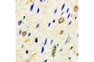 Immunohistochemical analysis of CD59 staining in mouse brain formalin fixed paraffin embedded tissue section. (CD59 anticorps)
