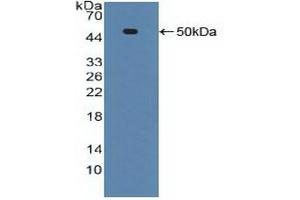 Western blot analysis of recombinant Human ADRbK1. (TNFRSF1A anticorps  (AA 60-236))