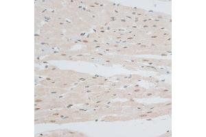 Immunofluorescence analysis of A-549 cells using ZNF148 antibody (ABIN6130815, ABIN6150463, ABIN6150464 and ABIN6222770).