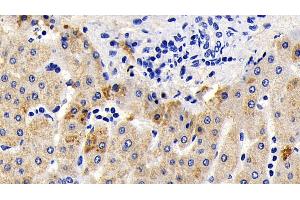Detection of AIF in Human Liver Tissue using Polyclonal Antibody to Apoptosis Inducing Factor (AIF) (AIF anticorps  (AA 103-322))