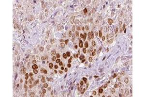 ABIN6266720 at 1/100 staining human liver tissue sections by IHC-P. (REV3L anticorps  (N-Term))