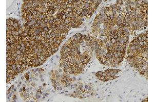 ABIN6277898 at 1/100 staining Human pancreas tissue by IHC-P. (Renin anticorps  (Internal Region))