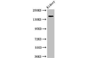 Western Blot Positive WB detected in: Rat kidney tissue All lanes: USP6 antibody at 4 μg/mL Secondary Goat polyclonal to rabbit IgG at 1/50000 dilution Predicted band size: 159, 122, 90 kDa Observed band size: 159 kDa (USP6 anticorps  (C-Term))
