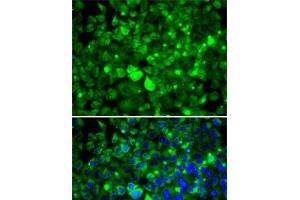 Immunofluorescence analysis of MCF7 cells using RPLP1 Polyclonal Antibody (RPLP1 anticorps)